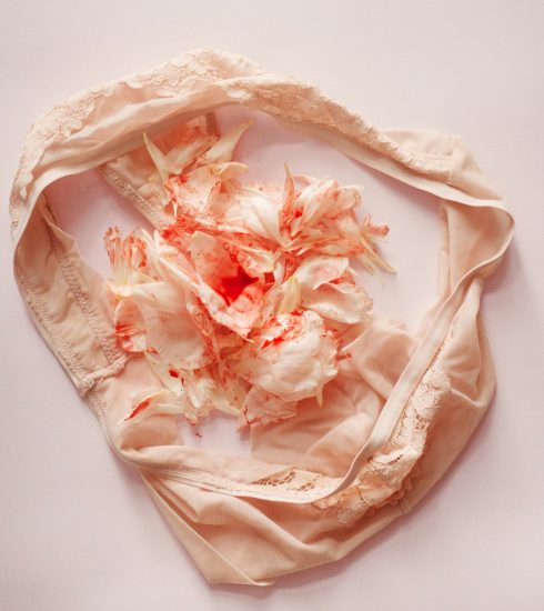 Adenomioza și menstruațiile extrem de abundente: cum îți poate influența viața de zi cu zi și ce opțiuni de protecție există