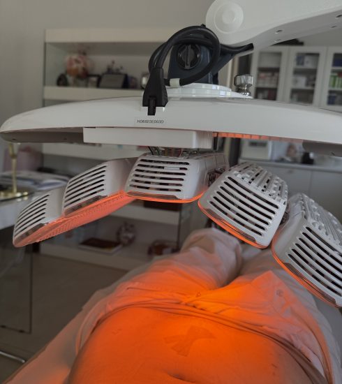 Cum m-a ajutat laserul LLLT să mă recuperez după operația de endometrioză și histerectomie subtotală